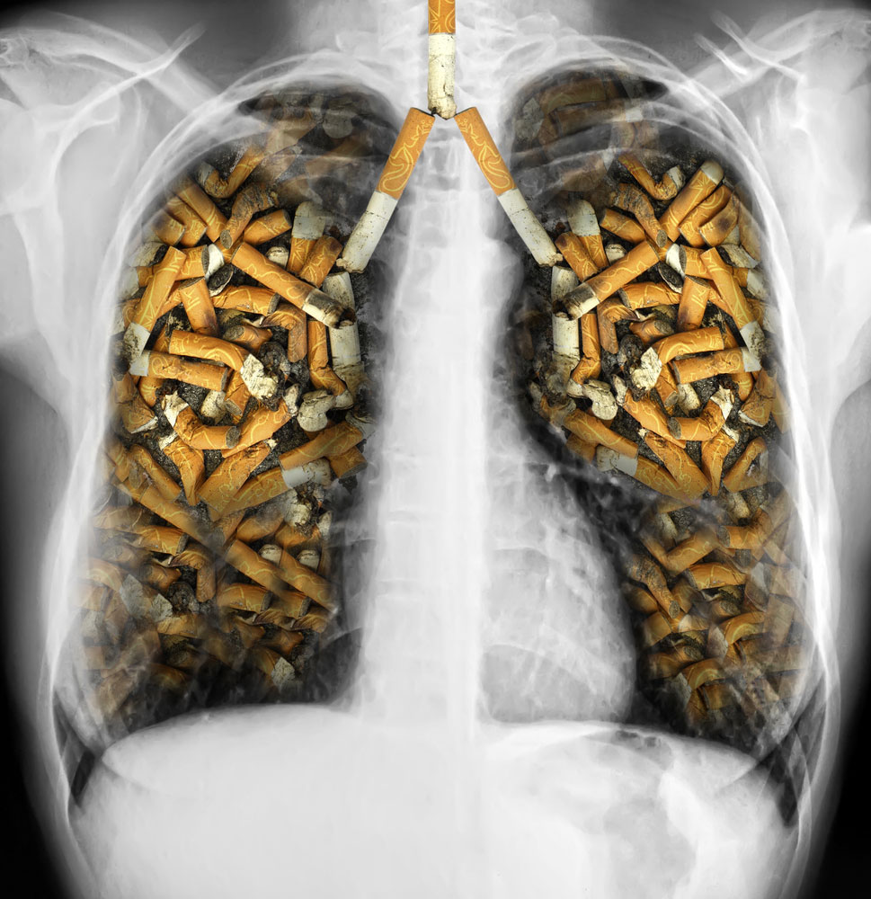 Smoking Affects Your Heart and Blood Vessels